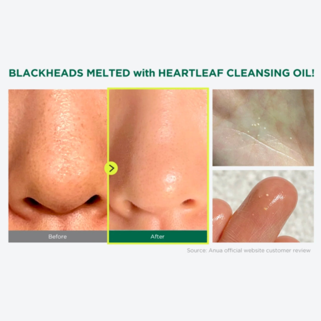 Limpiador en Aceite Facial Para Poros Anua - Pore Facial Oil Cleanser 20ml