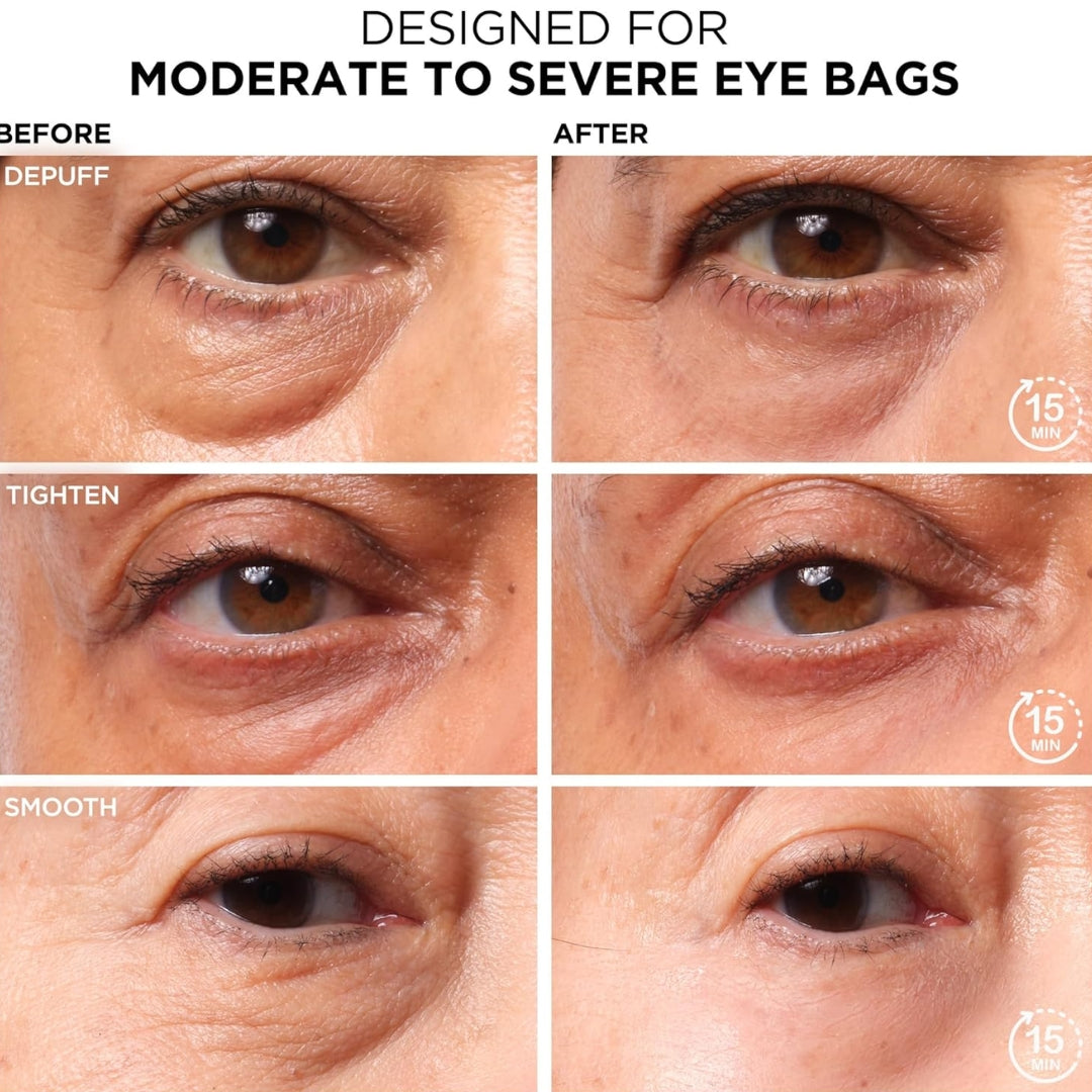Contorno de Ojos Para Bolsa IT Cosmetics | Under Eye Bags Daytime Treatment for Eye Bags, Puffiness and Crepey Skin Bye Bye