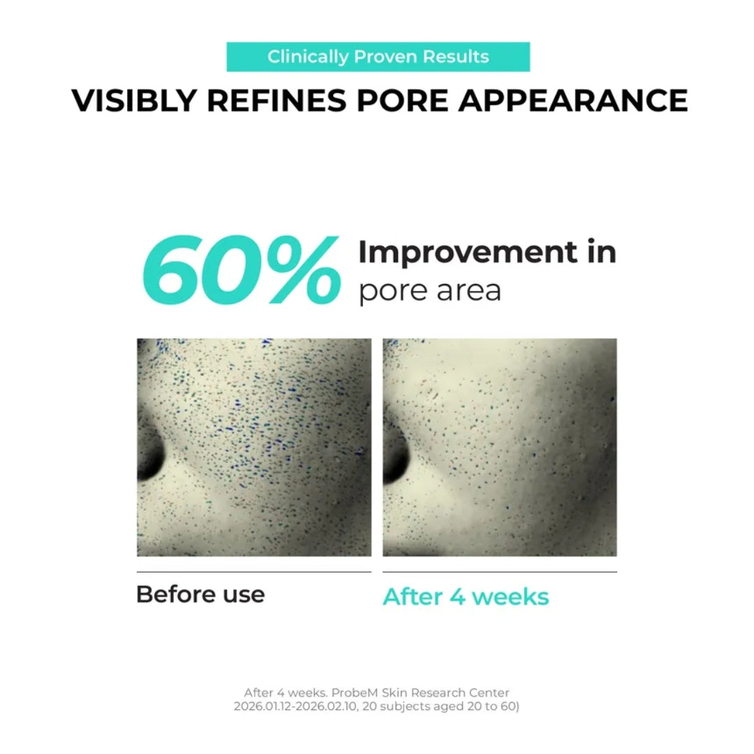 Parches para la nariz Overnight Zero Pore Nose Patch (10 patches) Jumiso