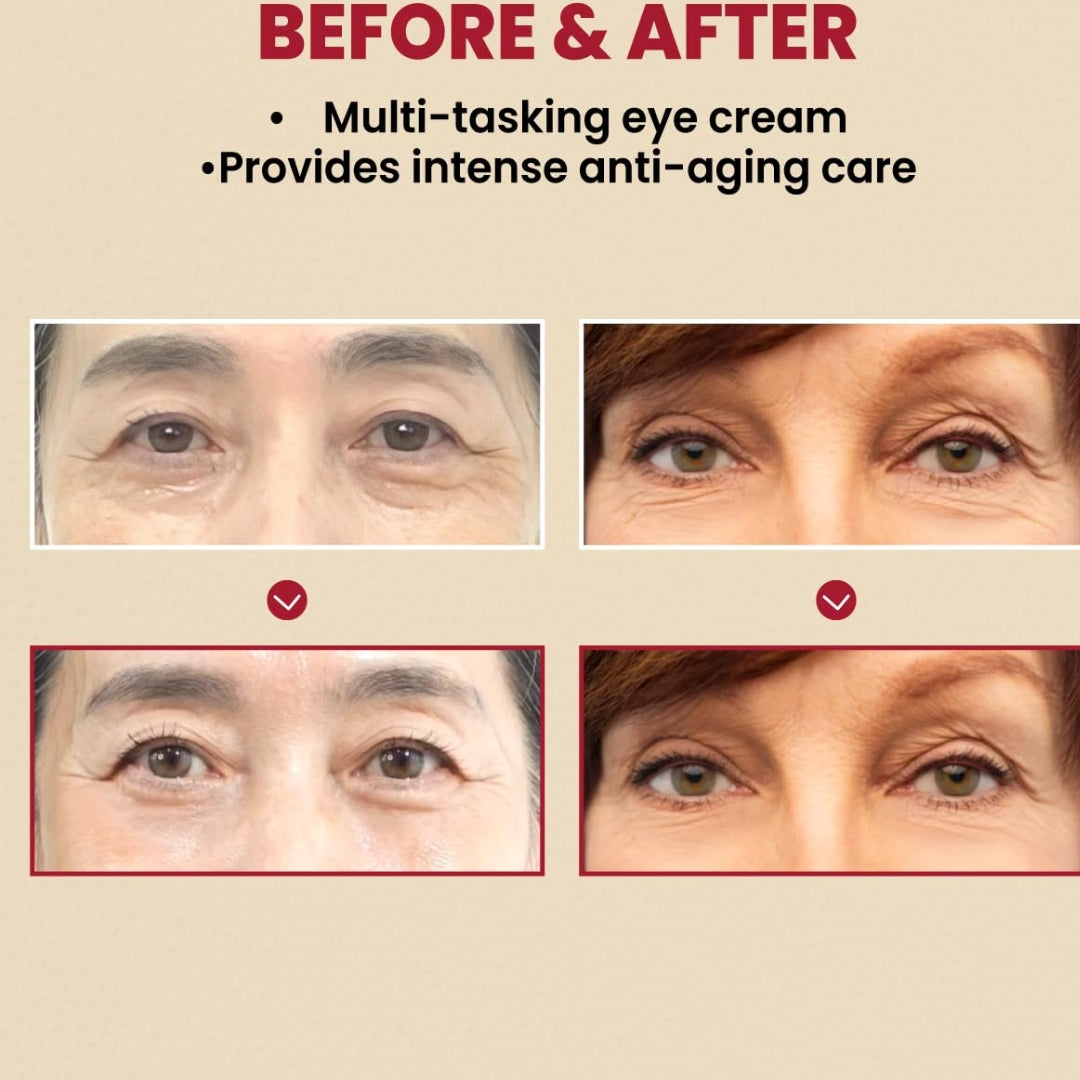 Contorno de Ojos Eye Cream : Retinal Liposome 4% + Fermented Bean Seoul 1988 KSECRET