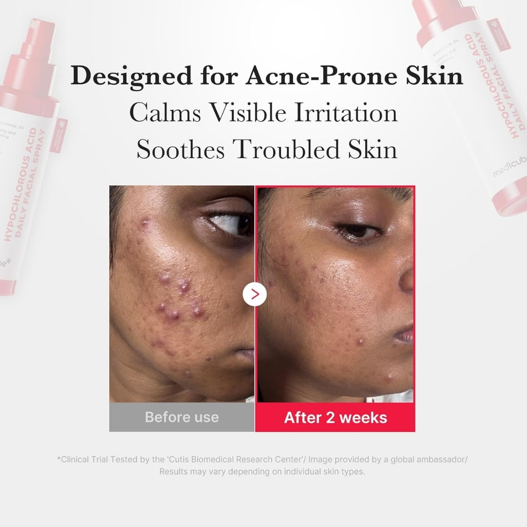 Spray facial (Bruma Hidratante) Hypochlorous Acid Daily Facial Spray Medicube