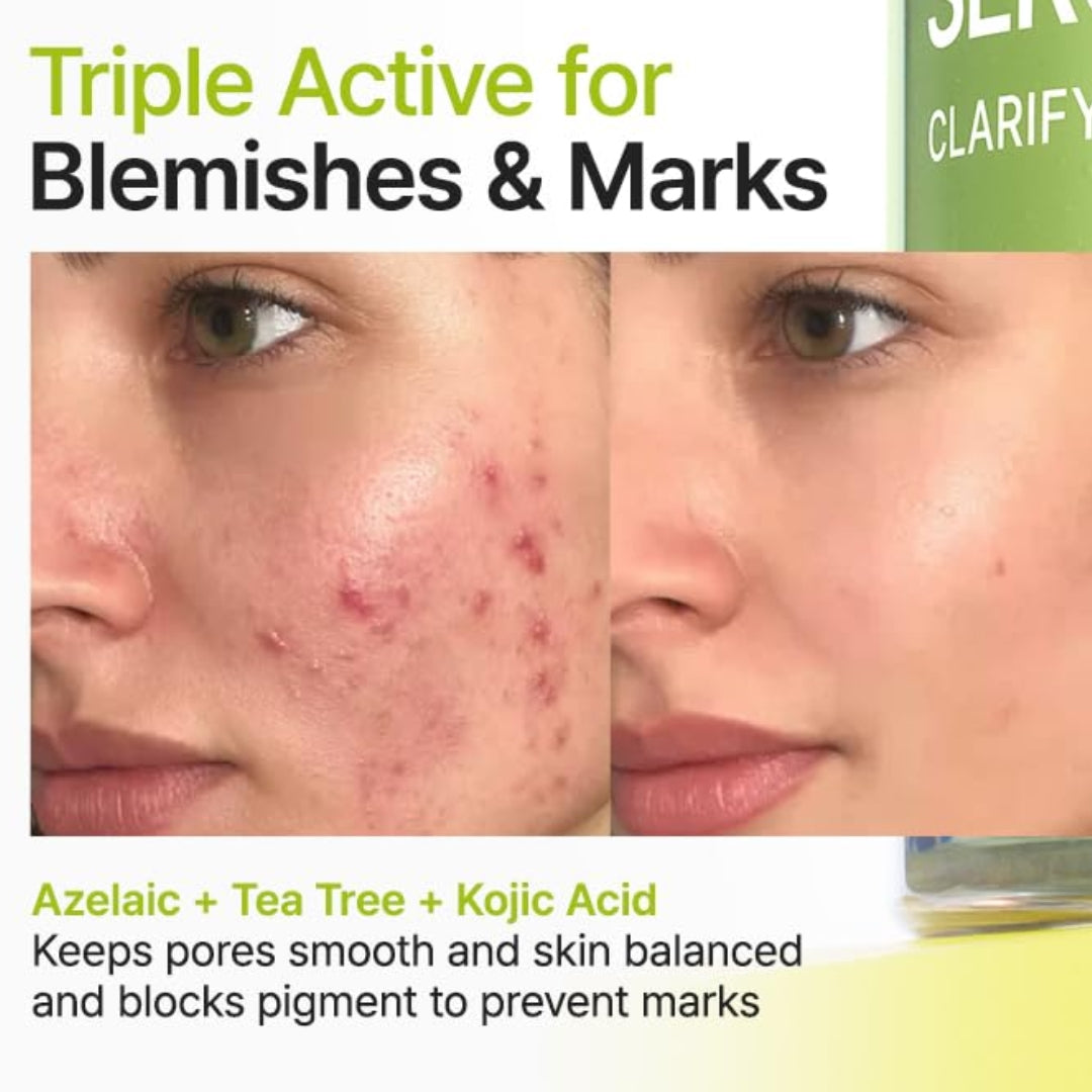 Serum de Azelaic Acid 10 Kojic Tea Tree Purito