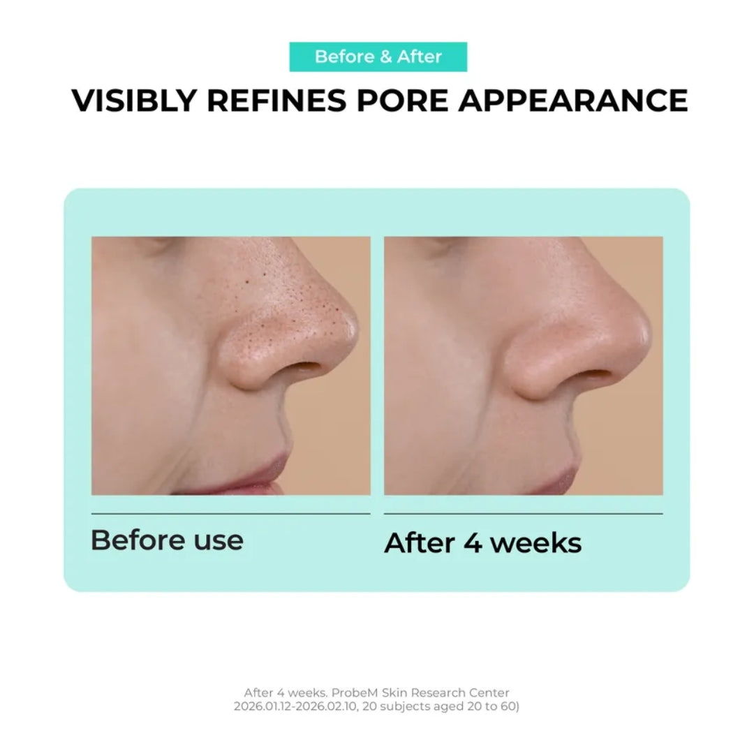 Parches para la nariz Overnight Zero Pore Nose Patch (10 patches) Jumiso