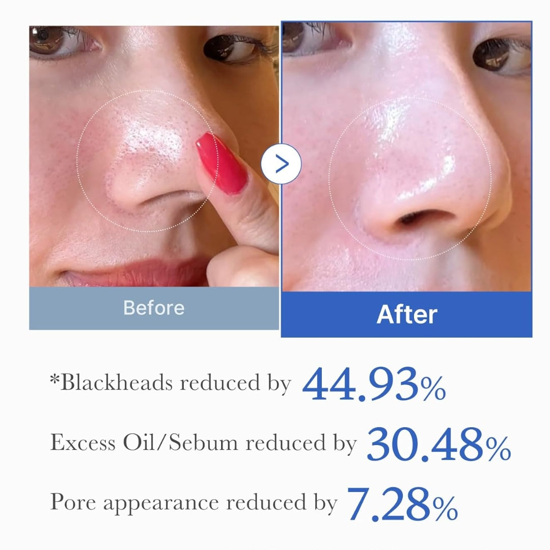 Pads Zero Pore Pad 2.0 (70 Unidades) Medicube