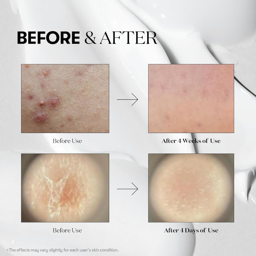 Microagujas VT Mild Reedle Shot 700 - Serum Mild Microneedling 30ml (Centella + Aloe) VT