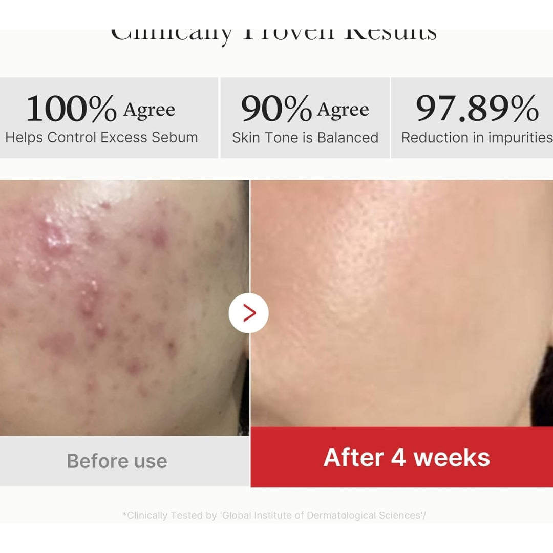 Pad Hidratantes Red Succinic Acid Peeling 70pcs Medicube h6