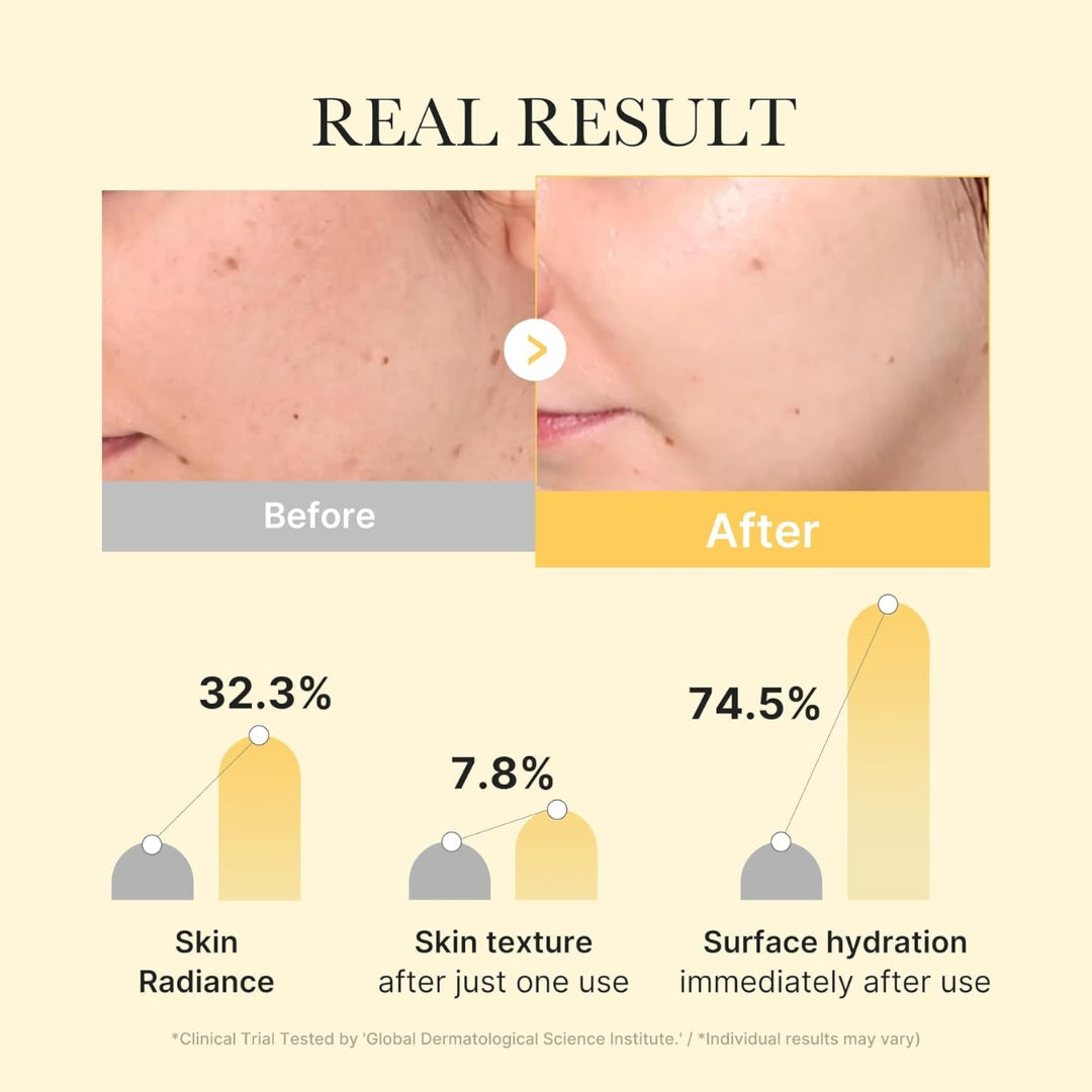 Mascarilla de gel iluminadora de cúrcuma Kojic Acid 4 Unidades Medicube