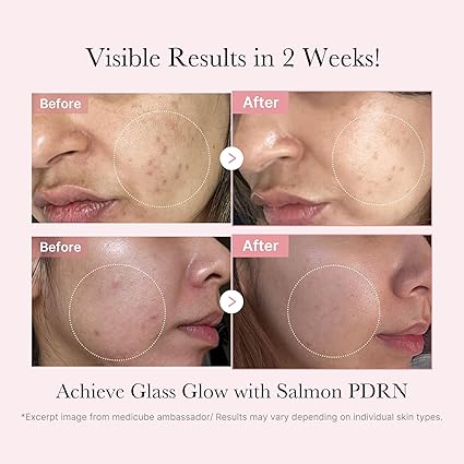 Medicube Salmon DNA PDRN – Kit Mini Glass Glow f19