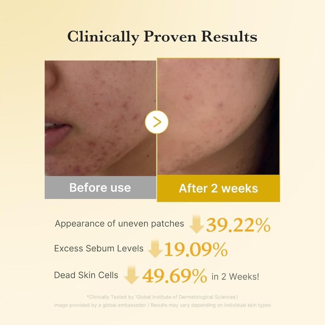 Pads (70ea)  Kojic Acid Turmeric Niacinamide Madicube f18