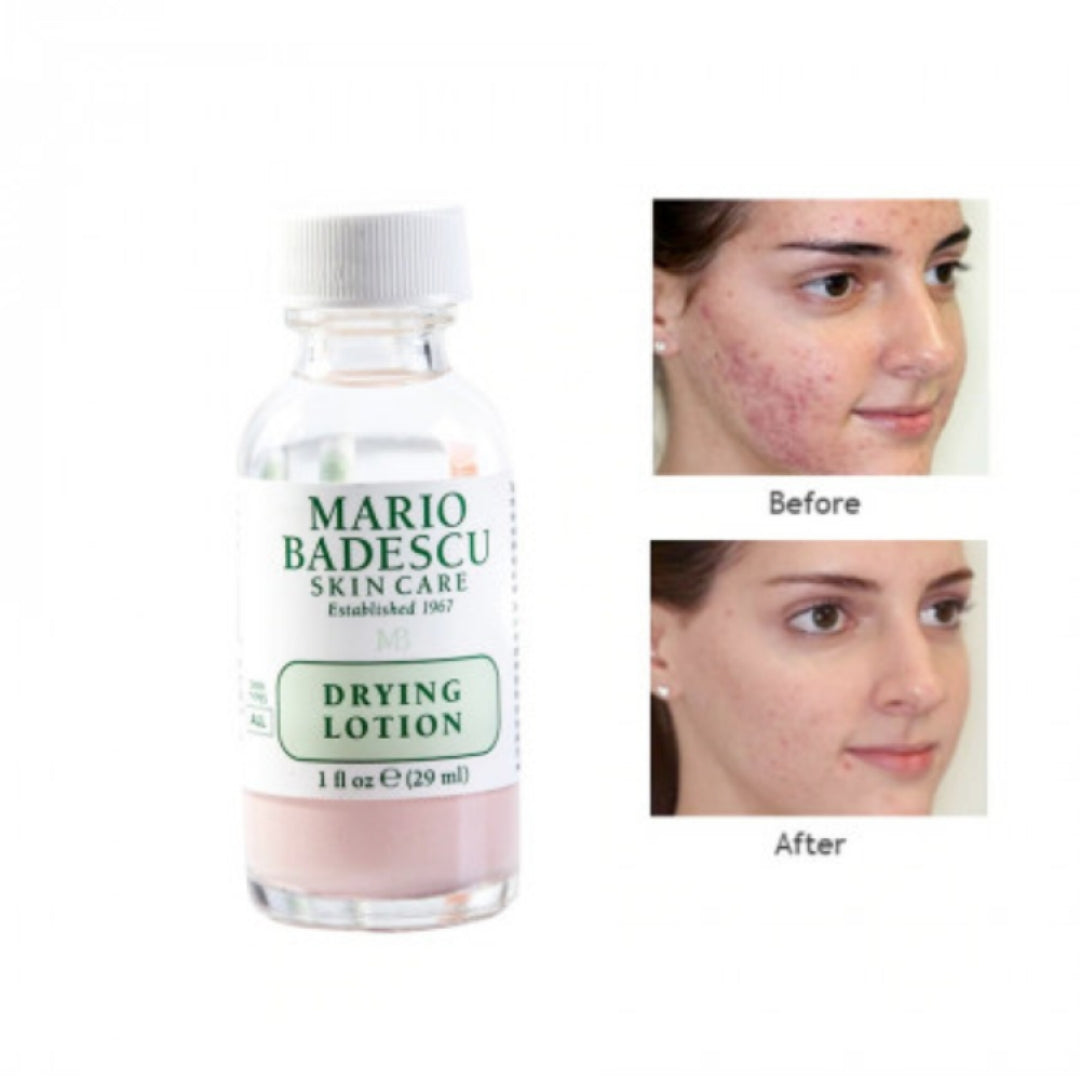 Localizador Drying Lotion - 29 ml Mario Badescu