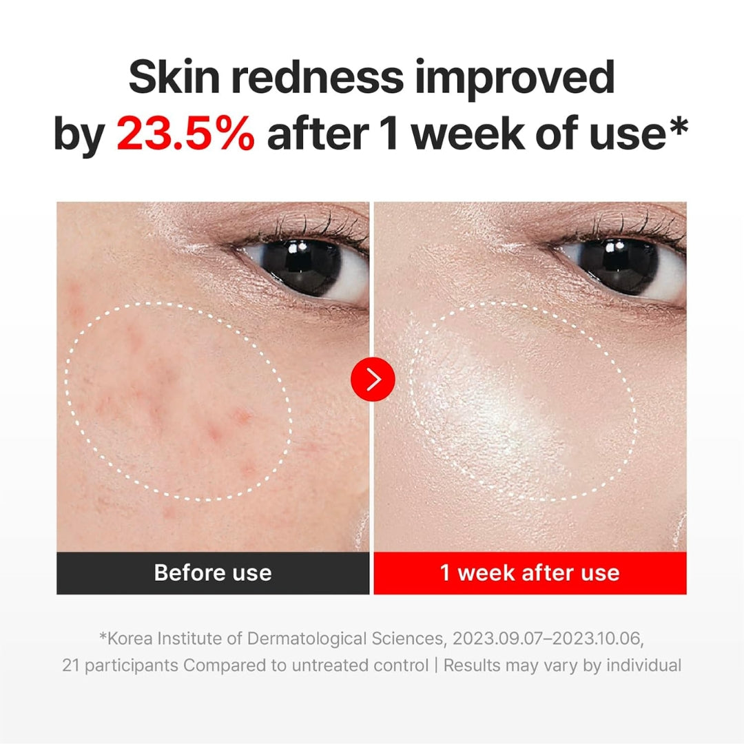 Crema Calmante  Anti-edad Madeca Cream Time Reverse Centellian24+