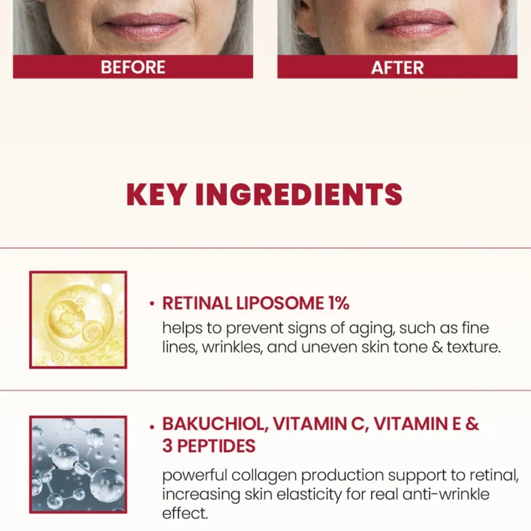 Crema Hidratante con Retinal Liposome 1% + Fermented Rice 50ml Seoul 1988 KSECRET