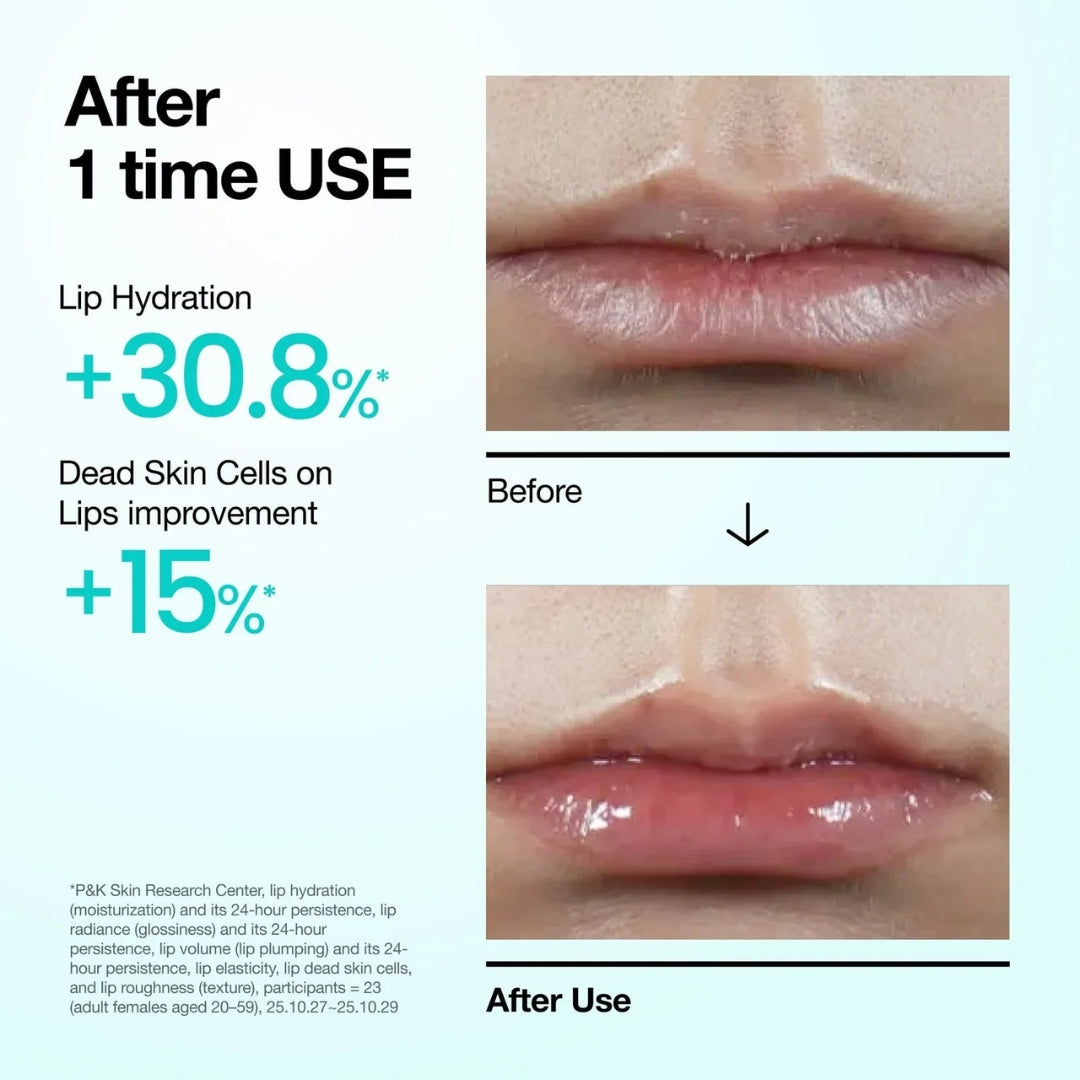 Lip Gloss PDRN Lip Serum 10ml Anua