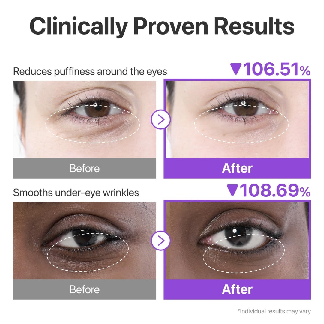 Parches Para Ojos No.9 NAD+ 5 pares  Collagen Under Eye Parches Numbuzin