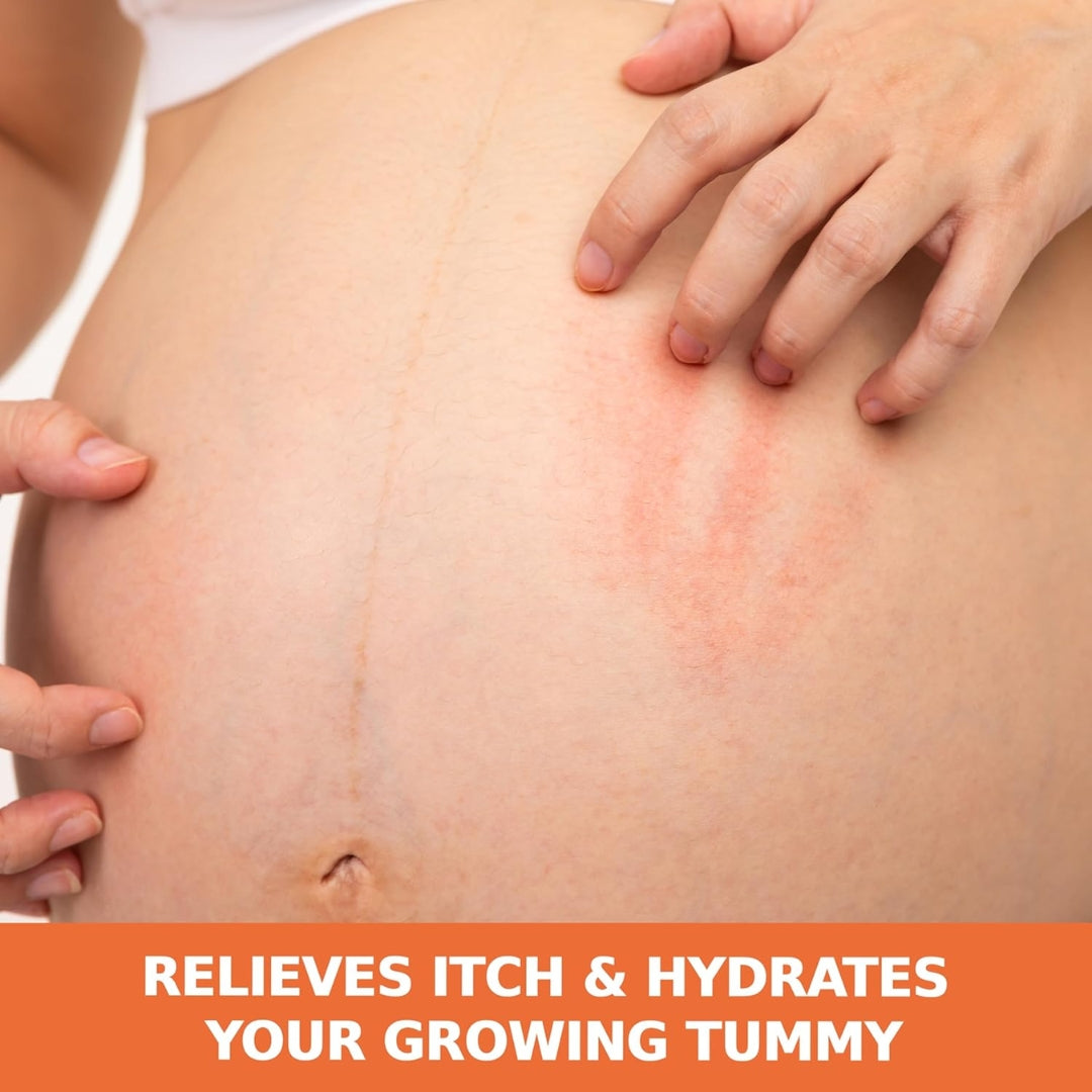 Aceite Hidratante corporal Dry Itchy Skin Anti Picor Palmer's 150ml