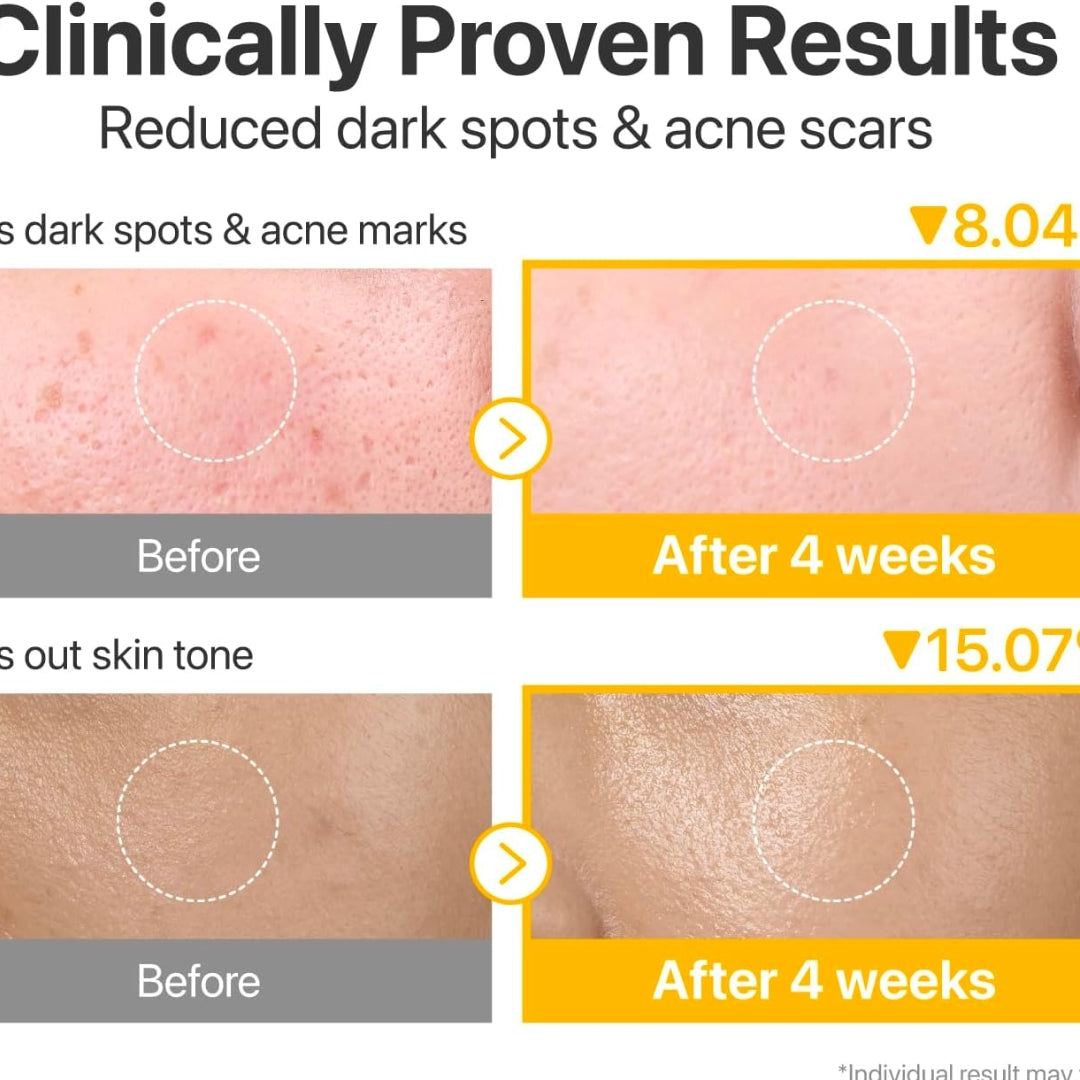 Pads No.5+ Glutathione Vitamin Concentrated Toner Pads - 70 unidades numbuzin