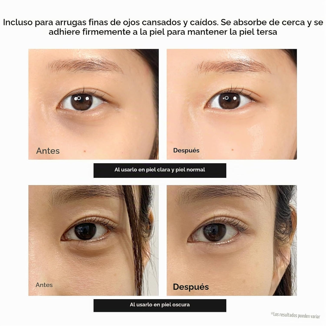 Contorno de Ojos Calcium Dark Spot Eye Cream 15g Dr.Melaxin