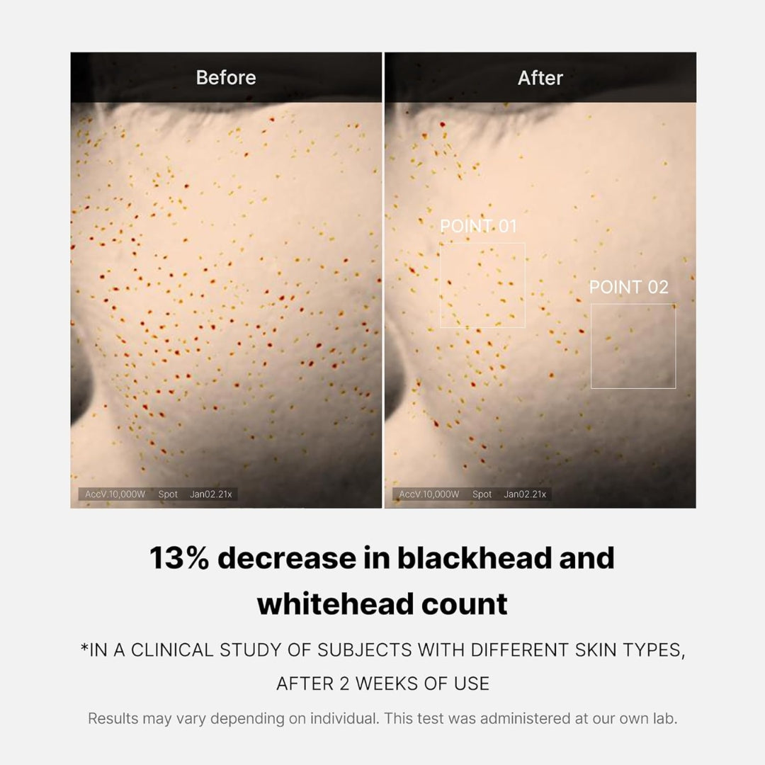 Serum Zero Pore One Day Serum 30ml