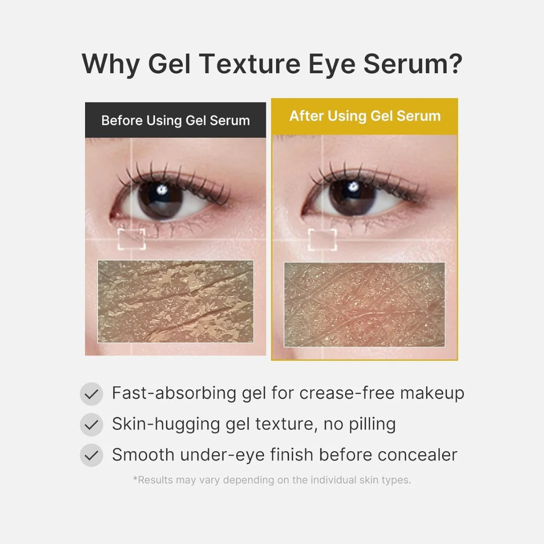 Contorno en gel con Kojic Acid Turmeric Vita Eye Gel Serum - 30ml Medicube
